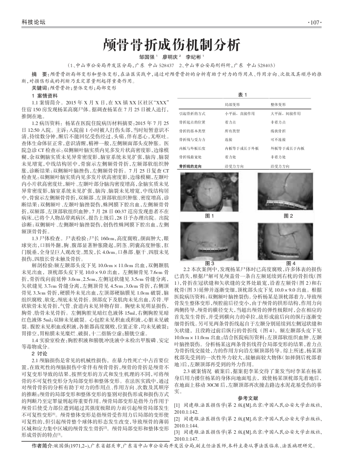 颅骨骨折成伤机制分析