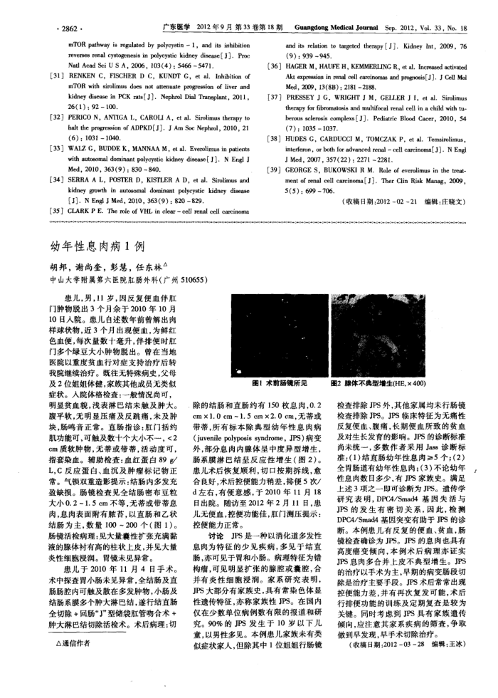 幼年性息肉病1例